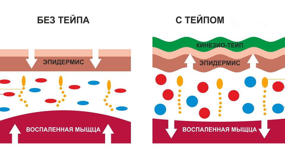 Кинезиотейпирование лица в домашних условиях схемы бесплатно