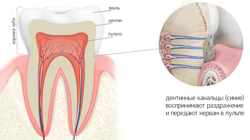 Эмалевый почему. Зубы чувствительная эмаль болят. Почему болят карманы в зубах. Чувствительности зубов к сплавам. Продуло челюсть болят зубы.