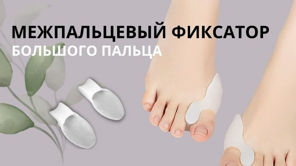Лечение вальгусной деформации большого пальца стопы