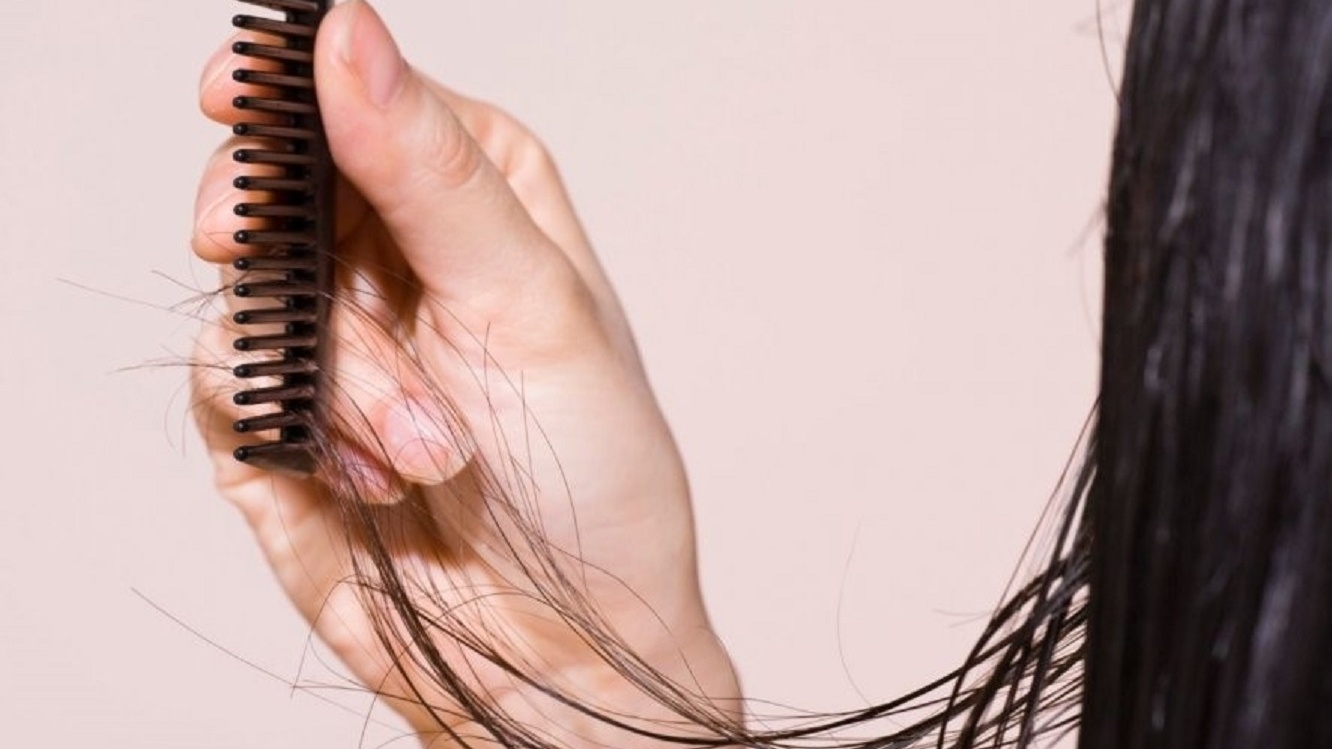 Выпадение волос при мытье. Диффузное выпадение волос. Норма выпадения волос при мытье. Линии какие волосы. Почему выпадают волосы при мытье.